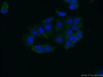 NME3 Antibody in Immunocytochemistry (ICC/IF)