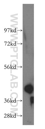 Creatine kinase B type Antibody in Western Blot (WB)