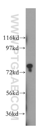 INPP5B Antibody in Western Blot (WB)