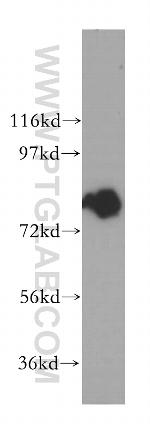 INPP5B Antibody in Western Blot (WB)