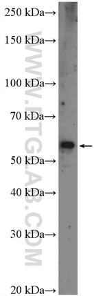 VPS72 Antibody in Western Blot (WB)