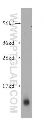 S100 beta Antibody in Western Blot (WB)