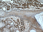 S100 beta Antibody in Immunohistochemistry (Paraffin) (IHC (P))