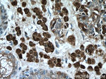 S100 beta Antibody in Immunohistochemistry (Paraffin) (IHC (P))