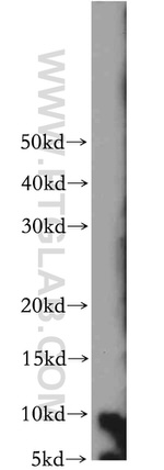 S100 beta Antibody in Western Blot (WB)