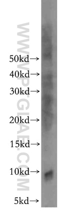 S100 beta Antibody in Western Blot (WB)