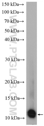 S100 beta Antibody in Western Blot (WB)