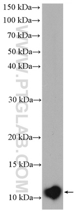 S100 beta Antibody in Western Blot (WB)