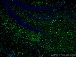 S100 beta Antibody in Immunohistochemistry (PFA fixed) (IHC (PFA))