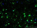 S100 beta Antibody in Immunohistochemistry (PFA fixed) (IHC (PFA))