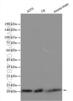 S100 beta Antibody in Western Blot (WB)