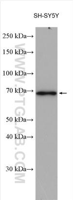 CEP68 Antibody in Western Blot (WB)