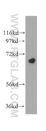 CEP68 Antibody in Western Blot (WB)