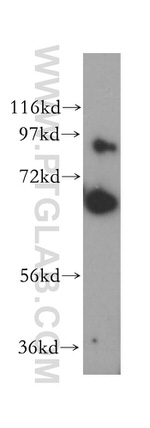 CEP68 Antibody in Western Blot (WB)