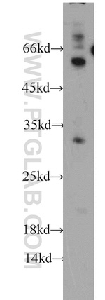 KCNE1 Antibody in Western Blot (WB)