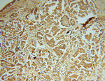 PIGK Antibody in Immunohistochemistry (Paraffin) (IHC (P))