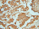 PIGK Antibody in Immunohistochemistry (Paraffin) (IHC (P))