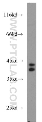 PIGK Antibody in Western Blot (WB)