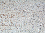 SFXN3 Antibody in Immunohistochemistry (Paraffin) (IHC (P))