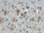 SFXN3 Antibody in Immunohistochemistry (Paraffin) (IHC (P))