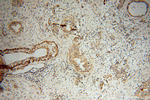 SFXN3 Antibody in Immunohistochemistry (Paraffin) (IHC (P))