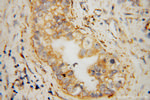 SFXN3 Antibody in Immunohistochemistry (Paraffin) (IHC (P))