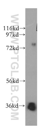 SFXN3 Antibody in Western Blot (WB)