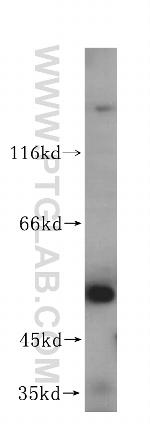 FUCA2 Antibody in Western Blot (WB)