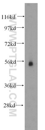 FUCA2 Antibody in Western Blot (WB)