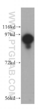 USP5 Antibody in Western Blot (WB)