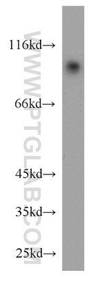 USP5 Antibody in Western Blot (WB)