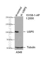 USP5 Antibody in Western Blot (WB)