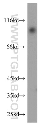 USP5 Antibody in Western Blot (WB)