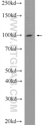 USP5 Antibody in Western Blot (WB)