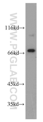 MEN1 Antibody in Western Blot (WB)