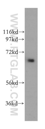 MEN1 Antibody in Western Blot (WB)