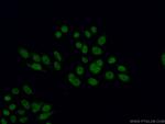 MEN1 Antibody in Immunocytochemistry (ICC/IF)