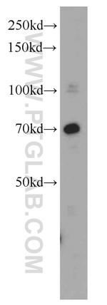 MEN1 Antibody in Western Blot (WB)