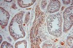 PGM1 Antibody in Immunohistochemistry (Paraffin) (IHC (P))