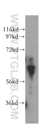 PGM1 Antibody in Western Blot (WB)