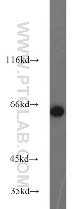 PGM1 Antibody in Western Blot (WB)