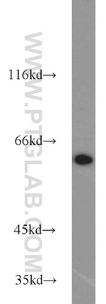 PGM1 Antibody in Western Blot (WB)