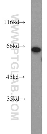 PGM1 Antibody in Western Blot (WB)