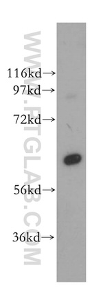 PGM1 Antibody in Western Blot (WB)