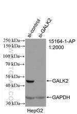 GALK2 Antibody in Western Blot (WB)