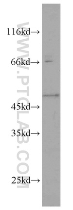 GALK2 Antibody in Western Blot (WB)