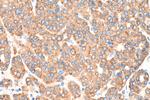 SIGMAR1 Antibody in Immunohistochemistry (Paraffin) (IHC (P))