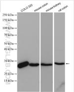 SIGMAR1 Antibody in Western Blot (WB)