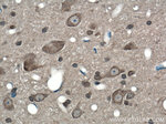 SIGMAR1 Antibody in Immunohistochemistry (Paraffin) (IHC (P))