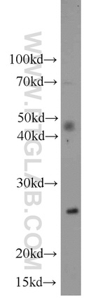 SIGMAR1 Antibody in Western Blot (WB)